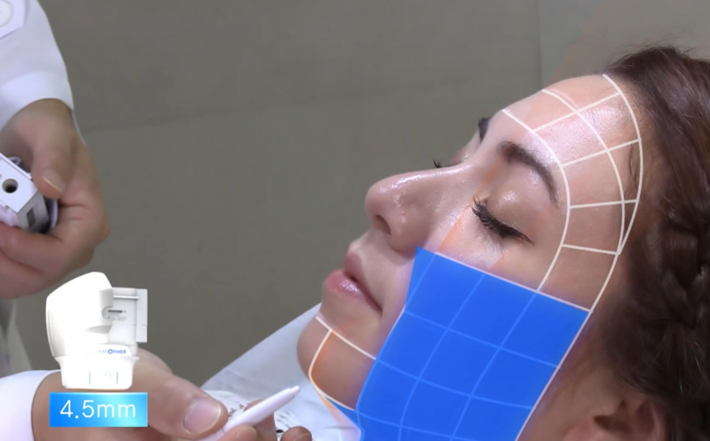 دستگاه هایفو چهار بعدی بلک اولترا جوانسازی پوست با هندپیس ("ار اف فرکشنال")