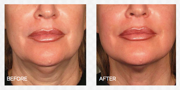 تصاویر قبل استفاده ازدستگاه 