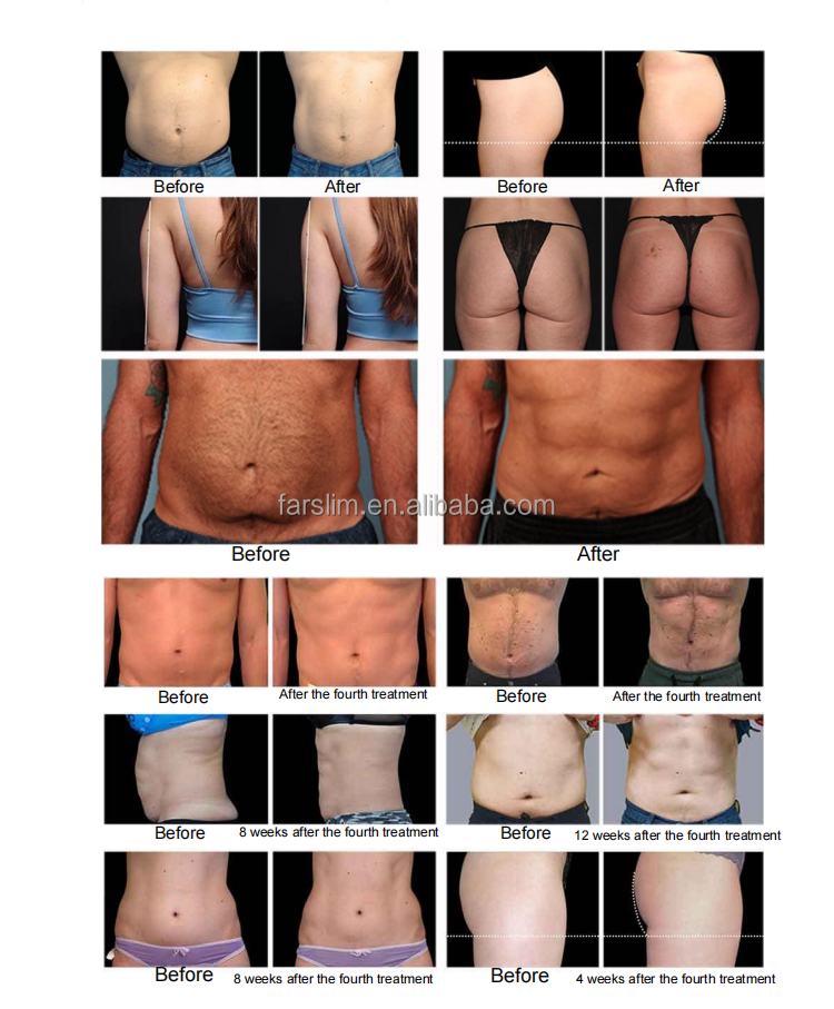 دستگاه EMS ZERO PRO لاغری و عضلهسازی همزمان بدن و صورت