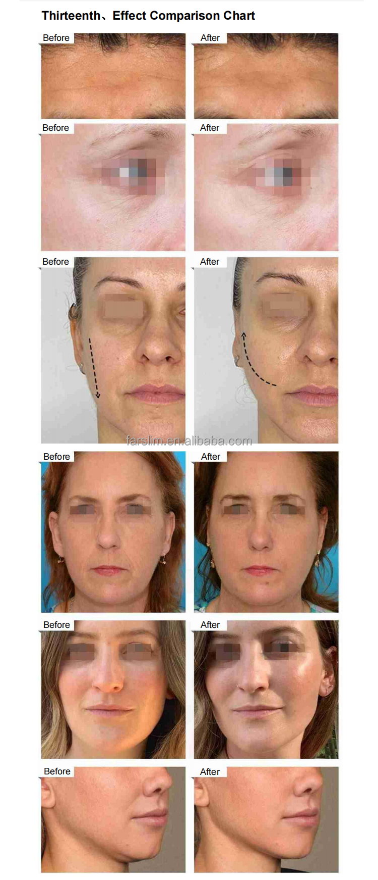 دستگاه EMS ZERO PRO لاغری و عضلهسازی همزمان بدن و صورت